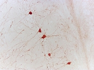 bs-0160R - Neurotrophin 3 / NTF3
