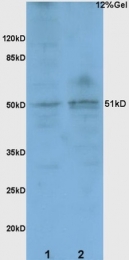 bs-0164R - BACE1