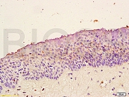 bs-0175R - TrkB