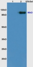 bs-0175R - TrkB
