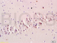 bs-0179R - DLG4 / PSD95
