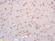 bs-0192R - TrkA