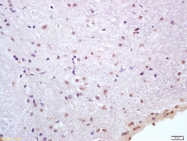 bs-0244R - Heat shock protein 70 / HSP70