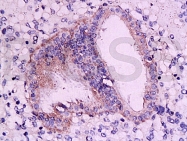 bs-0251R - RAR-alpha / RARA