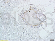 bs-0255R - Estrogen receptor beta
