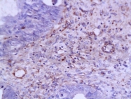 bs-0279R - VEGF-A
