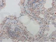 bs-0465R - RELA / NF-kB p65