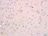 bs-0485R - EPHA2 / ECK