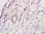 bs-0498R - Beta-1 adrenergic receptor