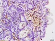 bs-0503R - CD18 / ITGB2
