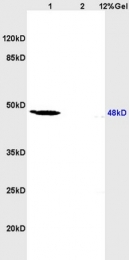 bs-0516R - RAR-beta / RARB