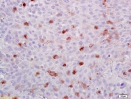 bs-0517R - ATF1