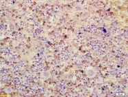 bs-0519R - ATF3