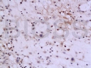 bs-0560R - Interleukin-13 / IL13