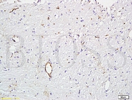 bs-0586R - von Willebrand factor (VWF)