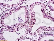 bs-0589R - WWOX / FOR