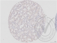 bs-0598R - Dishevelled-1 / DVL1