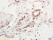 bs-0605R - Interleukin-2 / IL2