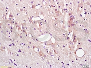 bs-0608R - CD54 / ICAM1