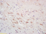 bs-0669R - PSCA