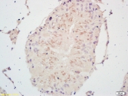 bs-0669R - PSCA