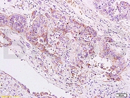 bs-0673R - VTCN1 / B7H4