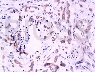 bs-0673R - VTCN1 / B7H4