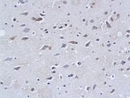 bs-0708R - Neurofilament H (200 kD)