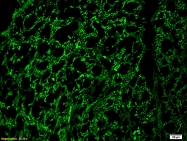 bs-0708R - Neurofilament H (200 kD)