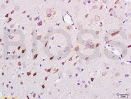 bs-0708R - Neurofilament H (200 kD)