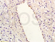 bs-0780R - Interleukin-8 / IL8