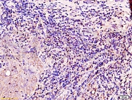 bs-0802R - BRCA1 / RNF53