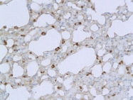 bs-0812R - Interleukin-1 beta / IL-1B