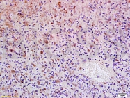 bs-0942R - ZMAT3