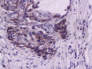 bs-0942R - ZMAT3