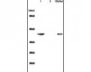 bs-0947R - Beta-2 adrenergic receptor