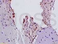 bs-0947R - Beta-2 adrenergic receptor