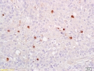 bs-0982R - RELA / NF-kB p65