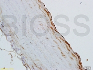 bs-0999R - GM-CSF