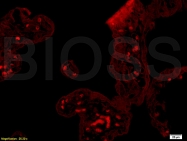 bs-0999R - GM-CSF