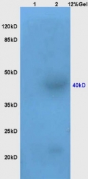 bs-10014R - Vasopressin V2 receptor (AVPR2)