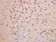 bs-10024R - HDAC3