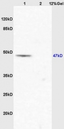 bs-10035R - EIF5