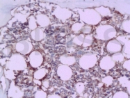 bs-1012R - BMP2 / BMP2A