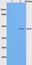 bs-1012R - BMP2 / BMP2A