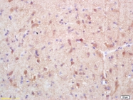 bs-10151R - XPO1 / Exportin-1