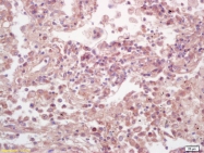 bs-10154R - ELK1