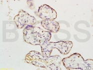 bs-1020R - MAPK3 / ERK1