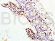 bs-1020R - MAPK3 / ERK1