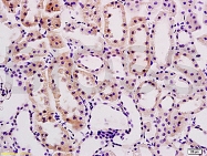 bs-1026R - Desmin